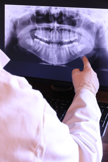 Best Dental Abscess Treatment in Saranac Lake, NY