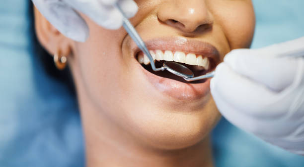 Best Emergency Dental Care for Sports Injuries in Saranac Lake, NY